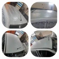 رفع آفتاب سوختگی