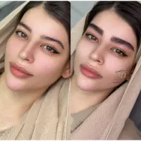 میکروبلیدینگ خط چشم رژلب و آموزش تتو و ریموو تتو
