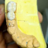 لابراتوار دندانسازی
