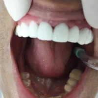 دستیار دندانپزشک