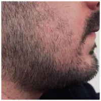 ریش سبیل رشد سبیل ریش