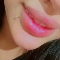 آف آموزش خدمات ژل بوتاکس مزولیزرلکه وگوشت اضاف