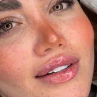 استخدام مدل جهت کلینیک زیبایی