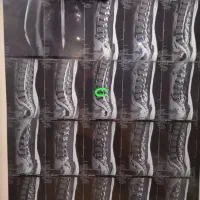 جااندازی مفاصل درد کمر و گردن طب ورزشی و اصلاح بدن