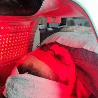 رفع تیرگی لب ها/ فیشال/ جوانسازی /کاشت مژه موقت