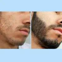 مرد شو|آرایشی، بهداشتی، درمانی|تویسرکان, |دیوار