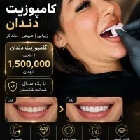 کامپوزیت دندان سرامیکی ازفکی12 باچک صیادی