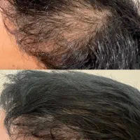 گیاهی بدون عوارض