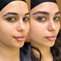 فیبروز میکروابرو میکرولیفت در شیراز زرهی