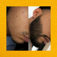 توم درش بیار