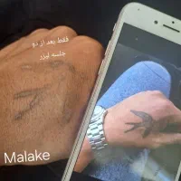 هایفو ریموو تاتو لیزر مزوتراپی ژل و بوتاکس لاغری