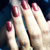 کاشت.لمینت.ژلتیپس