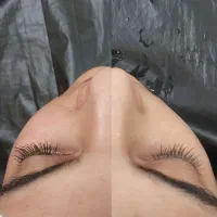 فیشیال تخصصی