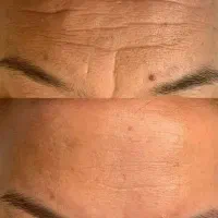 پودر و ژل کلاژن لاکچری کوین