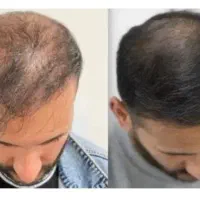 این اقدام آخریشه