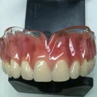 ساخت پروتز مصنوعی