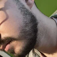رویش ریش تضمین میخوایی یا نتیجه...