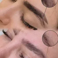پاک کردن تاتو صورت و بدن تخفیف تست رایگان
