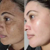 کرم روشن کننده ده کاره جایگزین بوتاکس و لیزر