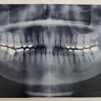 دندانپزشکی و دندانسازی حصارک بالا