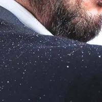 کرم ضد شوره از بین برنده کامل شوره با اولین مصرف