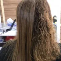 آفر ویژه احیا مو