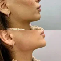 اجاره صندلی کلینیک و آموزش هنرجو