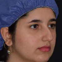عمل بینی ۴۵ ملیون دکتر متخصص با ۴۱ سال سابقه