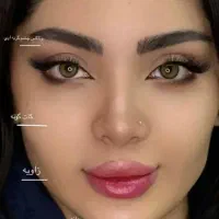 جشنواره،ژل،فیلر بادی تضمینی،مزوفیلرصورت تخصصی دقیق