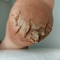 پدیکور حرفه ای  در بهبهان