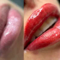 آرایش دائم (ابرو،بن مژه،لب)