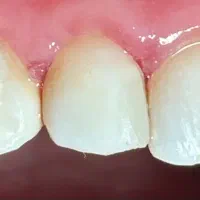 خدمات دندانپزشکی