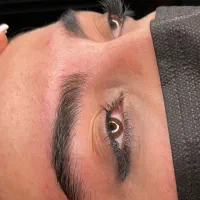مدل میکروبلیدینگ  فوری توسط استاد