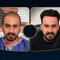 همکاری با لیدر