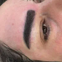 کاشت ابرو به روش طبیعی
