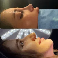 جشنواره جراحی و عمل بینی/پیکرتراشی