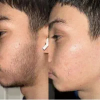 وقتی زشته که کمپشته