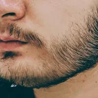 اقدام‌از شما پرپشتی از ما
