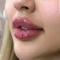 مطب زنان مامایی زیبایی