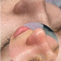 خدمات تخصصی فیشال (خانم ها، آقایان)
