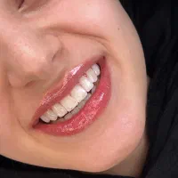لبخندی زیبا با خدمات استثنایی