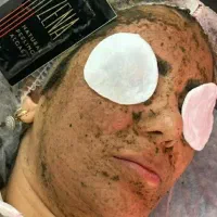 مزو تراپی وفیشیال تخصصی