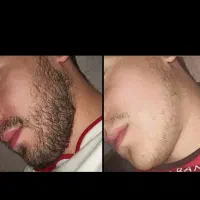 ریشو شو|آرایشی، بهداشتی، درمانی|تهران, توحید|دیوار