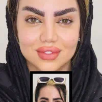 دایرکت ابرو وبلفاروفقط ۹تومن