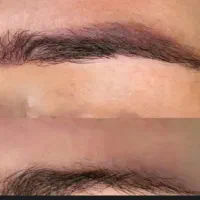 ریمووال