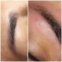 مرکز ریمو تک جلسه ای تتو،آنزیم تراپی،مزو رویش ابرو