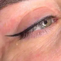 فیبروز و ریموو (رایگان) شیدینگ و بن مژه هزینه مواد