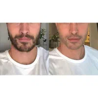 معجزه ریشات دست منه.