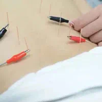 انجام طب سوزنی با دستگاه الکتروپانچر در منزل بیمار