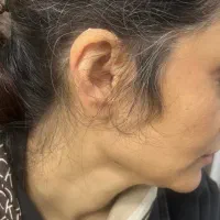 کلینیک شنوایی و سمعک دی/ از دم قسط بدون پیش پرداخت